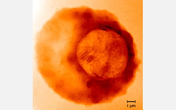 Photo of malaria parasite within a human red blood cell.