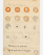 An 1800s sketch of the malaria parasite by the French doctor Alphonse Laveran.