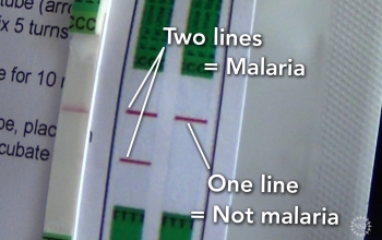 close up of malaria test