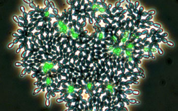 green cells undergoing cell death.