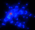 multi-cellular snowflake yeast with a blue cell-wall stain and red dead-cell stain.