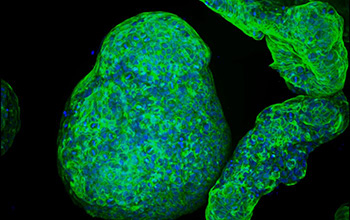 Researchers have developed a synthetic gel that can be used to grow pancreatic organoids, seen here.