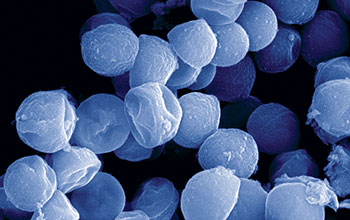 A scanning electron micrograph showing a <em>Staphylococcus aureus</em> biofilm
