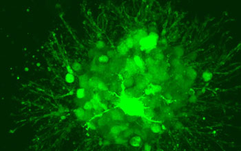 a cluster of cells found in the developing central nervous system