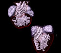 Images of embryo turtle heart on the left and embryo lizard heart on the right.