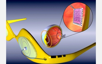 Retinal prosthetic system