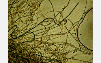 Microscopic photo of metal-oxidizing bacteria found in biofilm samples taken from gold mine bottom