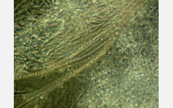 Microscopic photo of metal-oxidizing bacteria found in biofilm samples from bottom of gold mine
