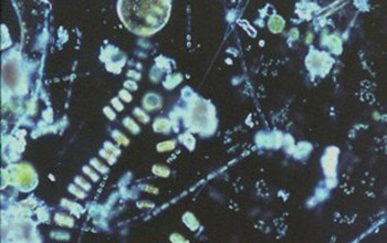 Close-up image of phytoplankton.