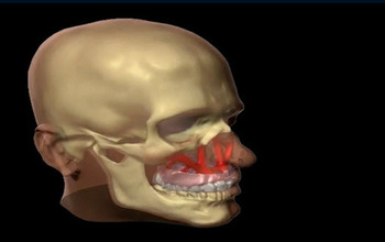 Illustration of skull with layers of material to be used to reconstruct face
