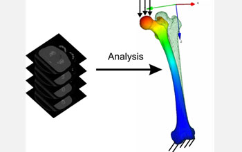 Stress analysis in a human femur performed directly from biomedical images.