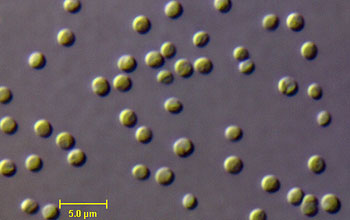 Micrograph of a small phytoplankton believed to be similar to the symbiont.