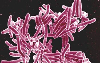 scanning electron micrograph of <em>Mycobacterium tuberculosis</em> bacteria