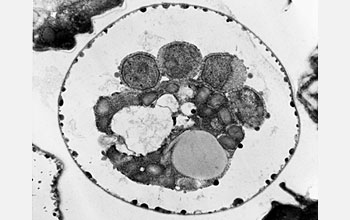Transmission electron micrograph showing a cross-section of a spore of Cryptosporidium.