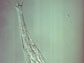 bdelloid rotifer