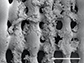 sarcoma (bone cancer) cells proliferate on the surface of a 3-D printed scaffold