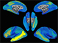 brain maps showing neural activation patterns
