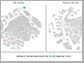 brain with and without t-SNE