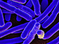 colorized scanning electron micrograph of Escherichia coli