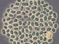 colony of cyanobacteria