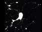 the damaged neuron