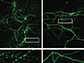 degeneration of dendrites in mouse hippocampal neurons