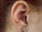 photo of an ear