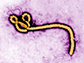a colorized transmission electron micrograph of an Ebola virus