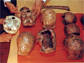skulls of Homo erectus