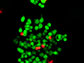 cancer cells response to immunotherapy drugs