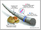 inhalable particles that can lodge in lung tissue