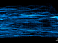 microtubules in a cardiomyocyte at rest