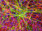 donor-specific motor neurons