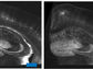 images of a mouse brain segment enlarged