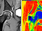 raw image data collected from dGEMRIC MRI protocol