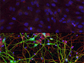 human skin cells (top) and medium spiny neurons