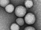 microscopy of neutrophil nanosponges