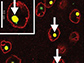 nuclear transport protein RanGAP1 (red) clumps up with mutant Huntingtin protein (green) in neurons