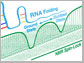 RNA as it folds as visualized by NMR spectroscopy