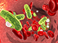 Sepsis, bacteria in blood