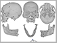 human skull bones