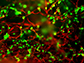 soft fibers (red) and T cells (green)