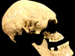 the Stuttgart skull from a 7,000-year-old skeleton