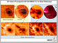 3-D views of sunspots with the BBSO telescope