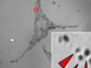 tracking proteins in melanosome including TPC2