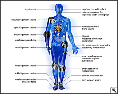 Graphic of human body with labels for all areas that can use wireless sensors -- Click to enlarge