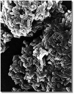 photomicrograph of E. coli