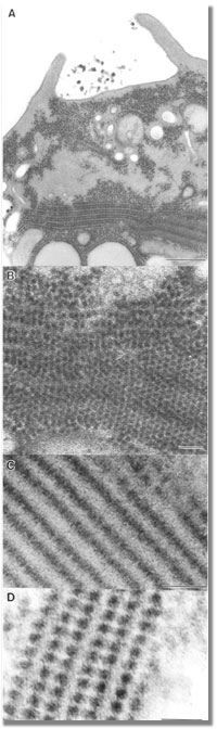 Hirano body within Dictyostelium amoeba
