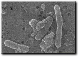 Photo of microbe