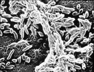 Photo: bacteria